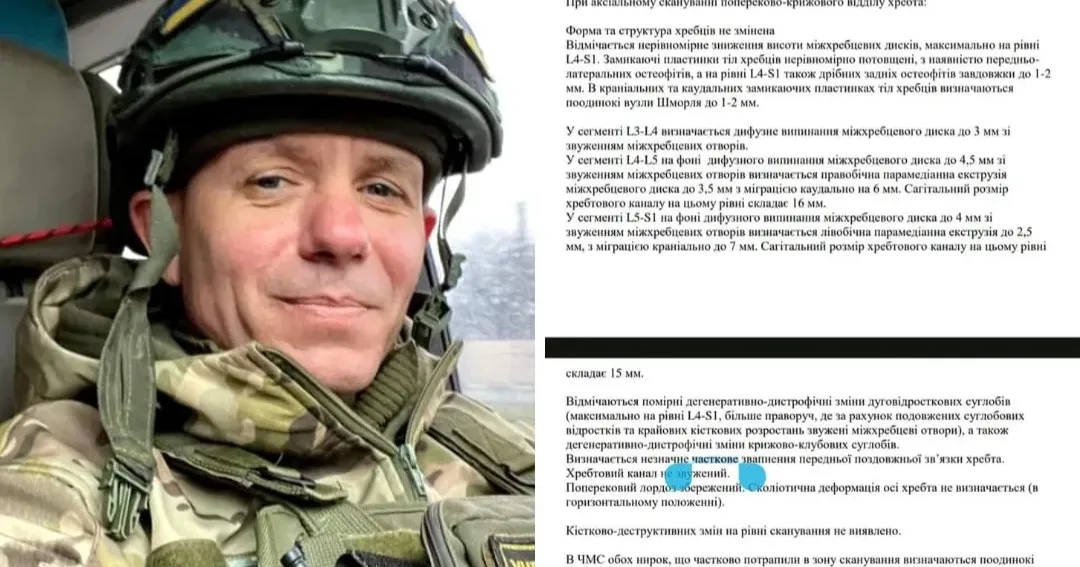 Фото - скріншот/фейсбук Валерію Ілічову треба зробити операцію попереково-крижового відділу хребта